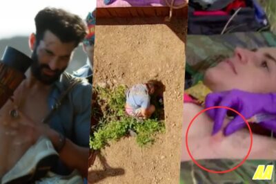 SHOCKING! The 14 Most Brutal Injuries in Australian Survivor History That Will Make You Squirm