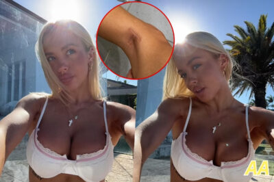 ‘A Wake-Up Call’: Tammy Hembrow Bares Nearly-Naked Truth About Skin Cancer Battle – The Scary Scar She’s Bravely Showing the World!